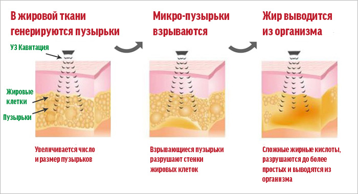 Липолиз - всё о правильном питании для здоровья на temakrasota.ru