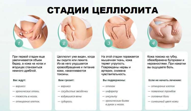 Антицеллюлитный массажер - всё о правильном питании для здоровья на temakrasota.ru